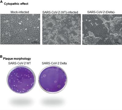 Studies on Growth Characteristics and Cross-Neutralization of Wild-Type and Delta SARS-CoV-2 From Hisar (India)